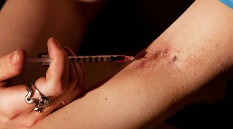 picture of person injecting heroin track marks