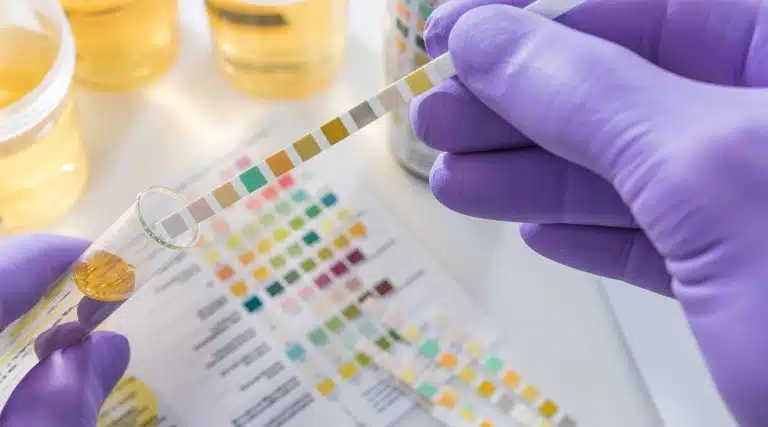 Suboxone drug testing detection times