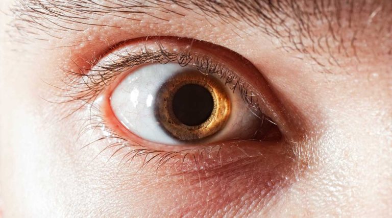 cocaine eyes cocaine pupils dilated pupils