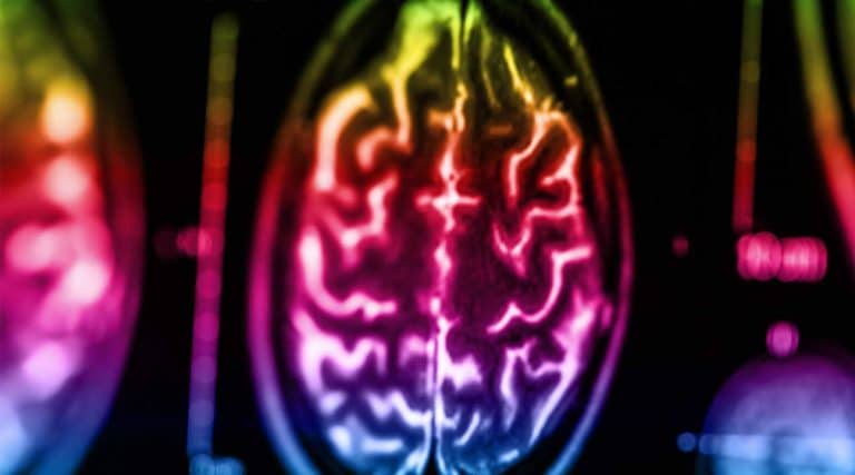 brain scan brain activity monitoring dopamine levels in the brain