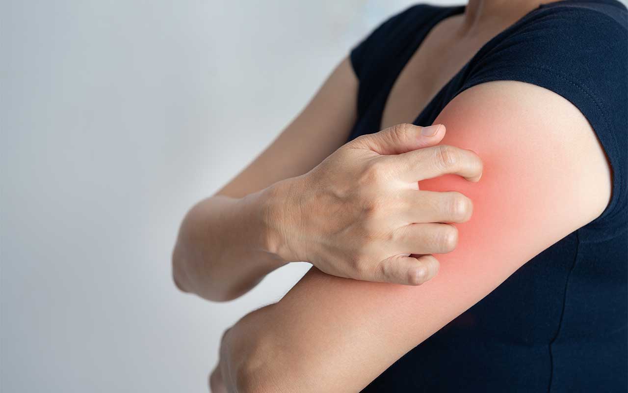Why Do Opiates (Codeine, Morphine, Oxycodone) Make You Itch?