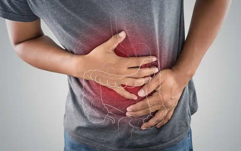 How To Manage Opioid-Induced Constipation