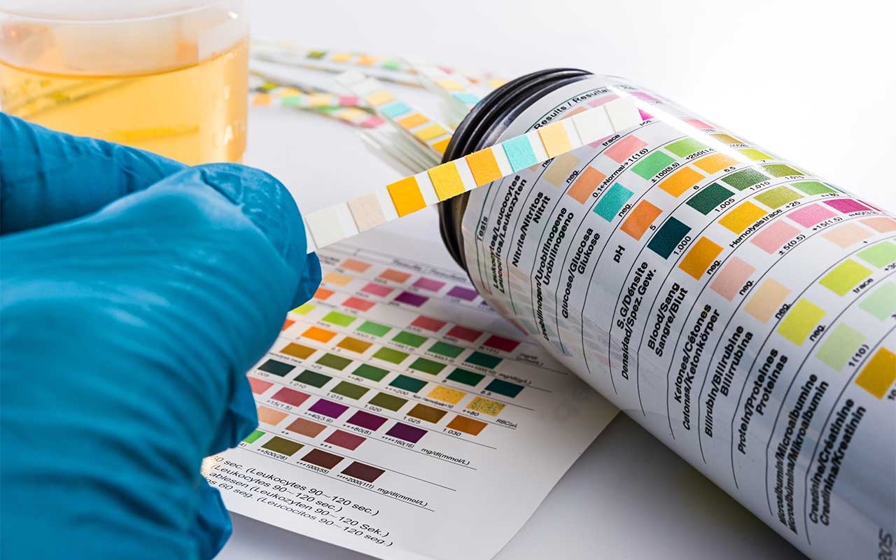 how long does adderall stay in your system for a blood test how long does adderall stay in your system for a blood test