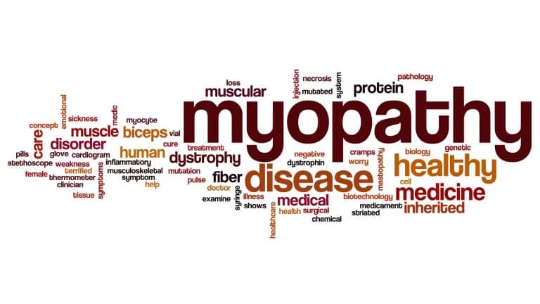 Alcoholic Myopathy | Causes, Symptoms, & Prevention