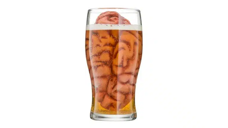 Alcoholic Wet Brain Syndrome | What Is Alcoholic Wet Brain Syndrome?