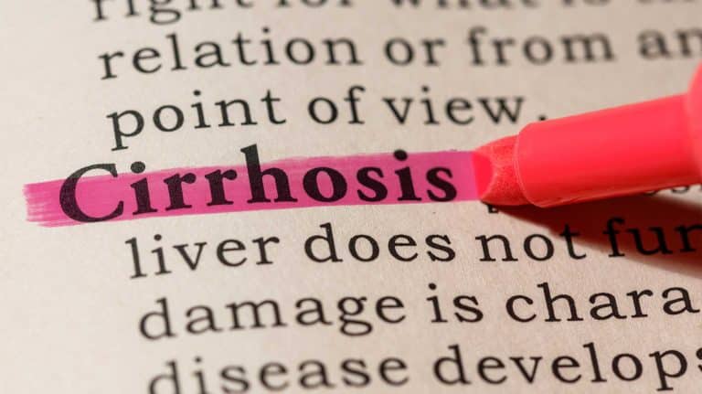 Alcoholic Cirrhosis | Signs, Causes, & Treatment
