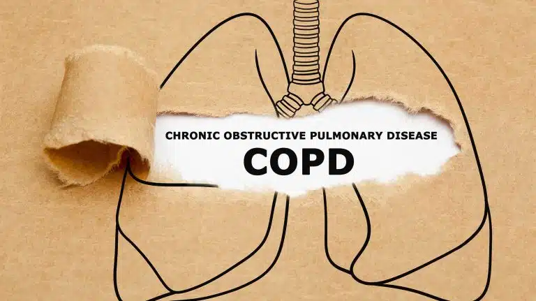 How Does Alcohol Affect Chronic Obstructive Pulmonary Disease (COPD)?
