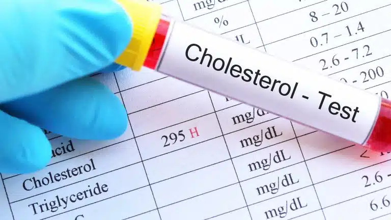 How Drinking Alcohol Affects Your Cholesterol