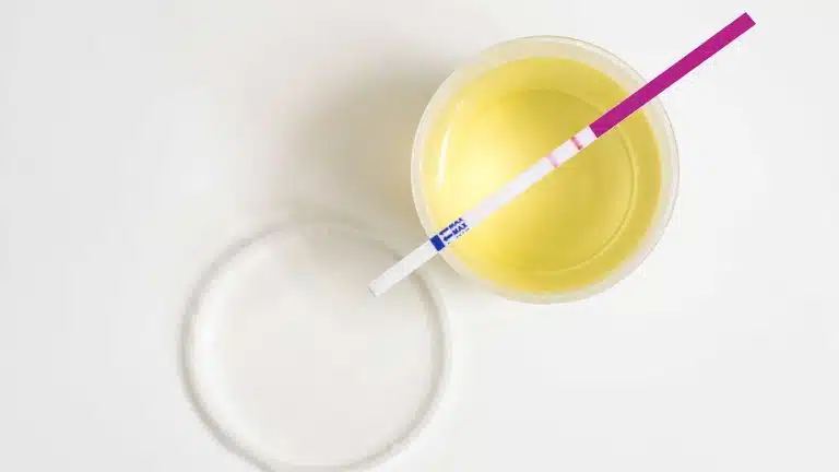 Alcohol Urine Tests | How Long Does Alcohol Stay In Your Urine?