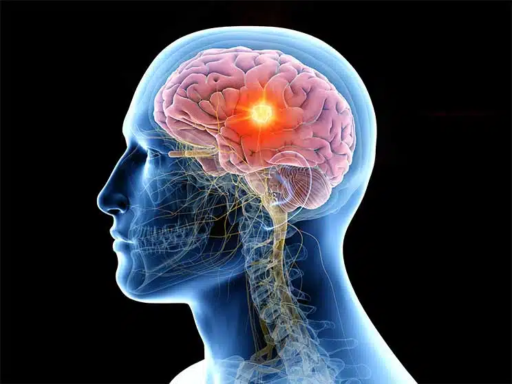 The Brain-How Drug & Alcohol Abuse Damages The Brain
